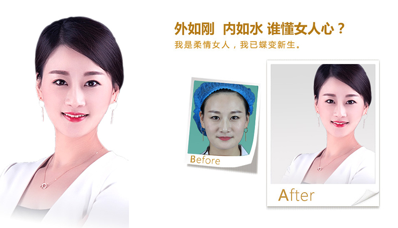 武汉V脸、线雕隆鼻